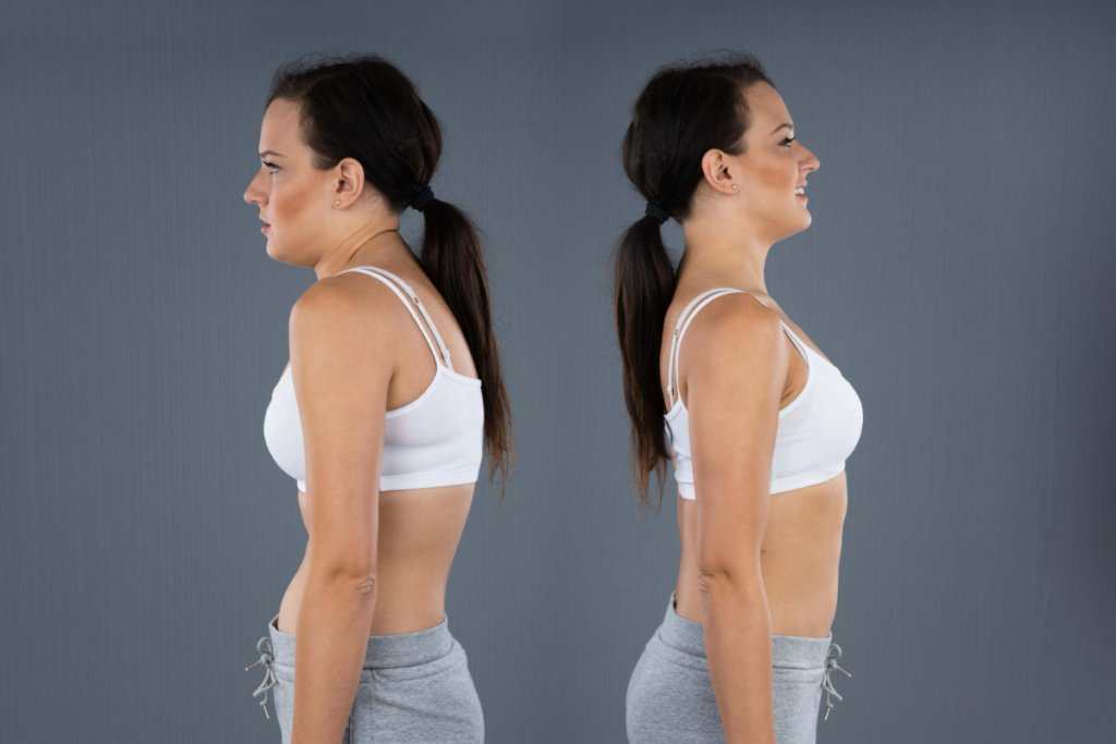 bone density in menopause