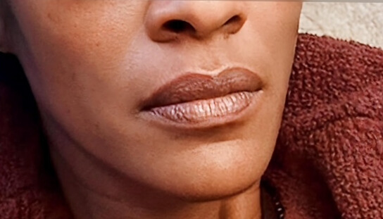 How to Prevent Dry Lips in Winter: A Hydration Ritual That Actually Works