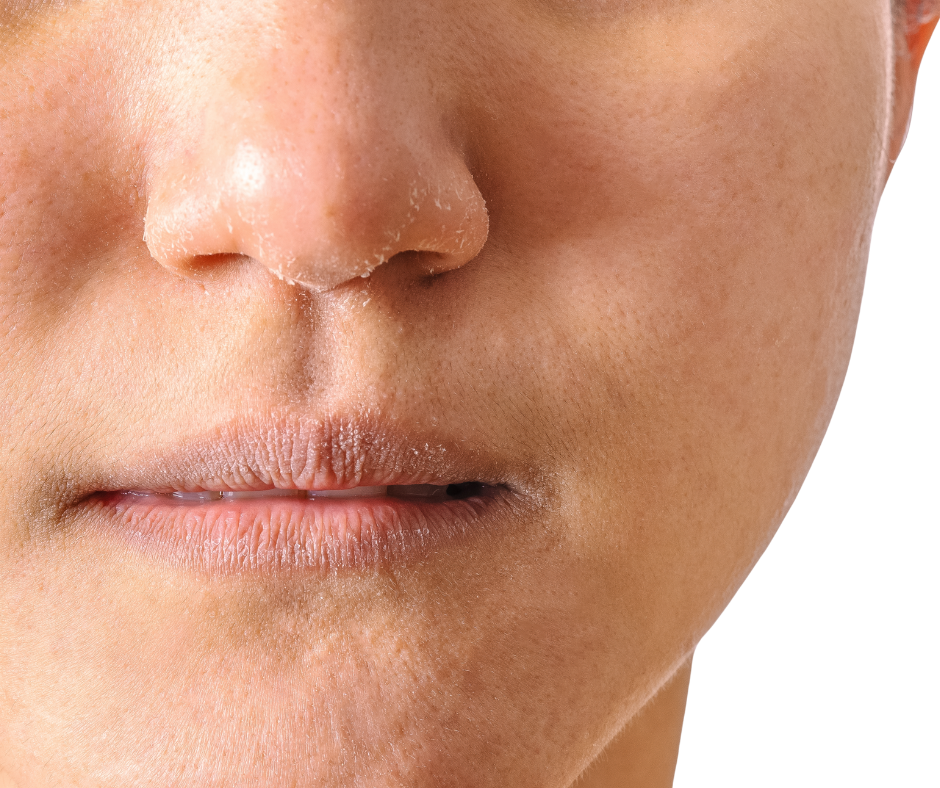 flaking or rough patches,