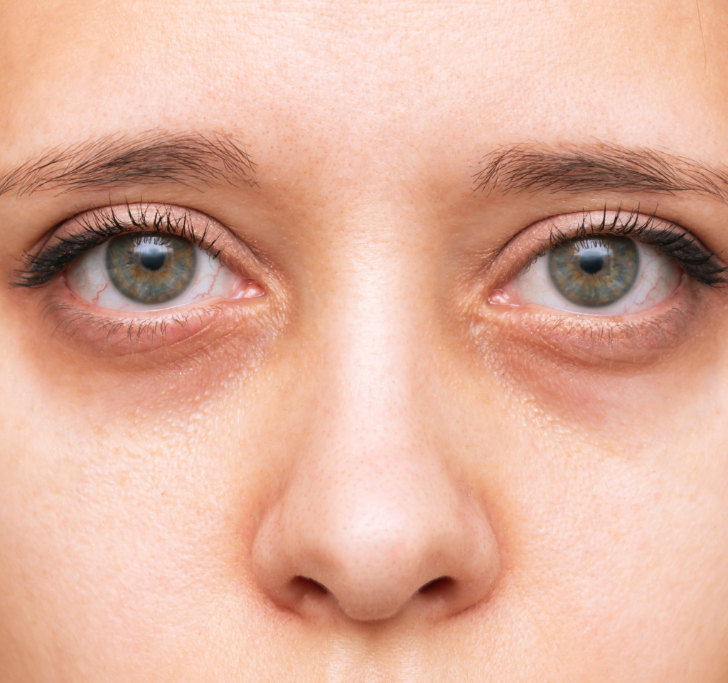 Stress and Collagen